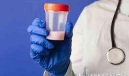 精液检查在线观看,揭秘男性生育健康秘密